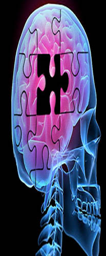 El Alzheimer se puede detectar diez años antes