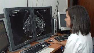Los cánceres de mama que podría evitar la quimioteraria