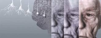 Estimulación visual, una nueva puerta para tratar el Alzheimer