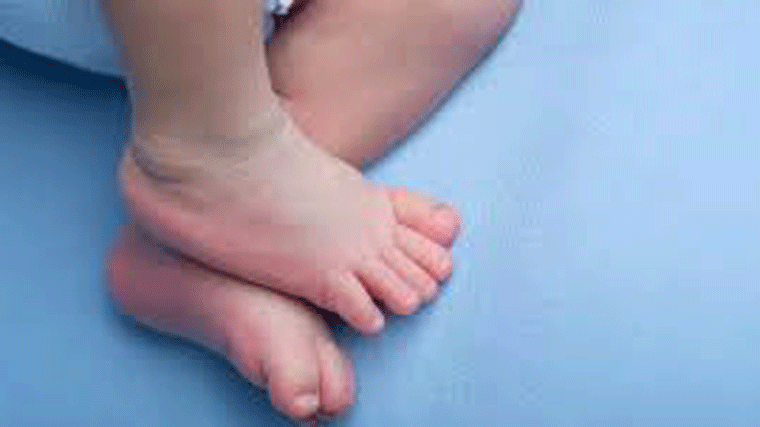 Proyecto de cribado genómico para detectar más de 300 enfermedades raras en bebés