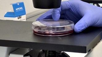 Eficacia de una nueva vacuna contra el Ébola confirmada en el Hospital 12 de Octubre de Madrid