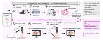 Innovadora tecnología de IA mejorará la cirugía del cáncer de mama en Europa