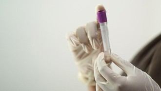Certificación de calidad ‘CAT’ para el Servicio de Hematología del Hospital Príncipe de Asturias en Madrid