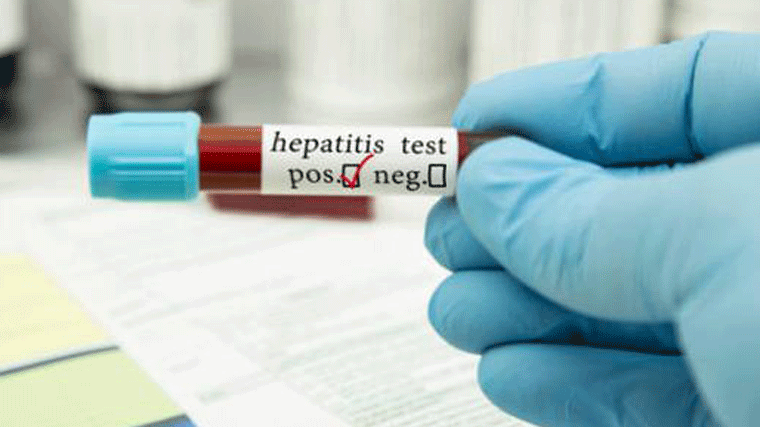OMS alerta: Uun brote de hepatitis 'de origen desconocido' afecta a los niños