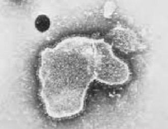 Detectan infecciones por VRS resistentes al tratamiento con nirsevimab