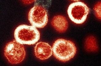 Identifican biomarcadores que predicen problemas óseos en pacientes con VIH