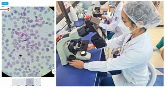 Desarrollan una IA que detecta el parásito de Chagas con un móvil en tiempo real