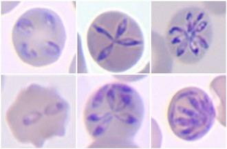 Descubren nueva especie de parásito que avanza el estudio de la babesiosis humana