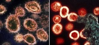 Persistencia del SARS-CoV-2 en personas con VIH revela alteraciones en microARNs tras COVID-19