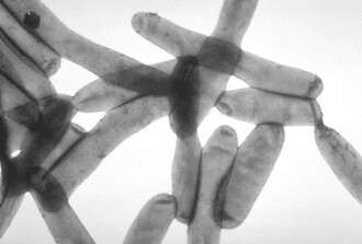 Riego agrícola podría propagar la bacteria de la legionelosis, advierten expertos