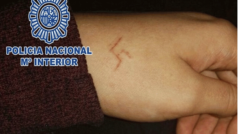 6 detenidos por marcar a una chica con una esvástica con un objeto candente