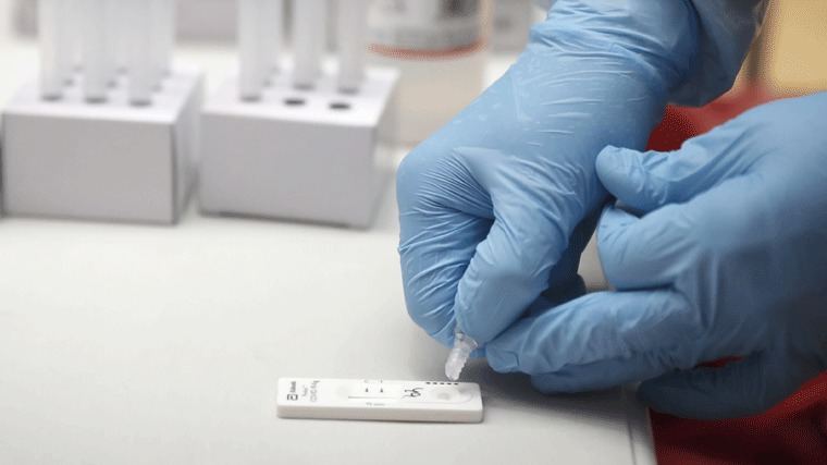 Sanidad fija un precio máximo de 2,94 euros para los test de antígenos