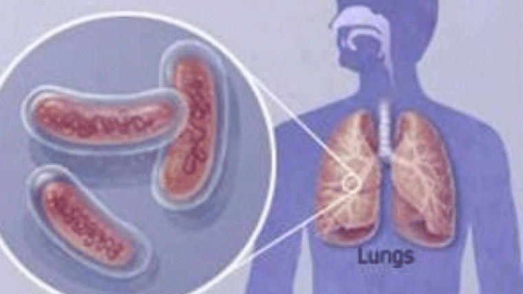 Cruz Roja atendió a 233 personas con tuberculosis, el 85% lo superó
